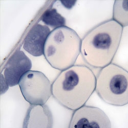 Mitosis Slide Set - 2 Prepared Slides