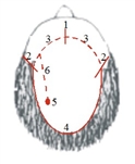 Custom Hair System Molding Kit