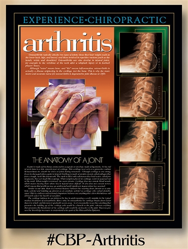 Arthritis: The Anatomy of a Joint 22 x 28 (non-laminated)