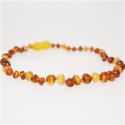 The Amber Monkey Baroque Baltic Amber 10-11 inch Necklace -Triple Cognac/Raw Lemon POP