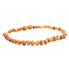 The Amber Monkey Baroque Baltic Amber 10-11 inch Necklace - Raw Cognac