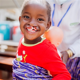 Help Provide Cleft Lip or Cleft Palate Surgery