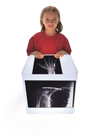 Fixed Bone X-Rays