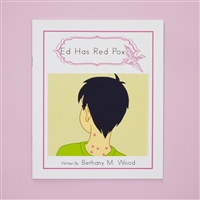 Ed Has Red Pox