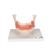 3B Scientific Dental Disease Model, Magnified 2 Times, 21 Parts - 3B Smart Anatomy
