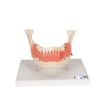 3B Scientific Dental Disease Model, Magnified 2 Times, 21 Parts - 3B Smart Anatomy