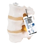 3B Scientific 3 Human Lumbar Vertebrae, Flexibly Mounted - 3B Smart Anatomy