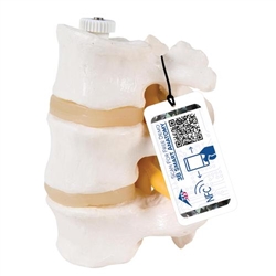 3B Scientific 3 Human Lumbar Vertebrae, Flexibly Mounted - 3B Smart Anatomy