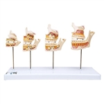 3B Scientific Dentition Development Model - 3B Smart Anatomy