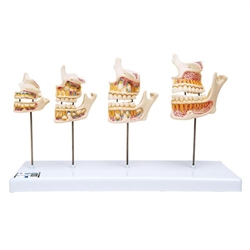 3B Scientific Dentition Development Model - 3B Smart Anatomy