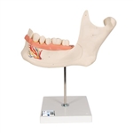 3B Scientific Half Lower Human Jaw Model, 3 Times Full-Size, 6 part - 3B Smart Anatomy