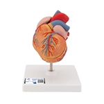 3B Scientific Classic Human Heart Model with Left Ventricular Hypertrophy (LVH), 2 Part - 3B Smart Anatomy