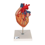 3B Scientific Human Heart Model with Bypass, 2 times Life-Size, 4 part - 3B Smart Anatomy