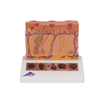 3B Scientific Skin Cancer Model with 5 stages, 8 times magnified - 3B Smart Anatomy
