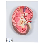 3B Scientific Kidney Section Model, 3 times Full-Size - 3B Smart Anatomy