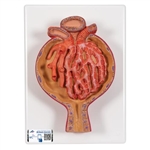 3B Scientific Model of Malpighian Corpuscle of Kidney, 700 times Full-Size - 3B Smart Anatomy