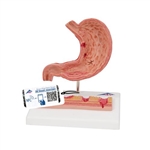 3B Scientific Human Stomach Section Model with Ulcers - 3B Smart Anatomy