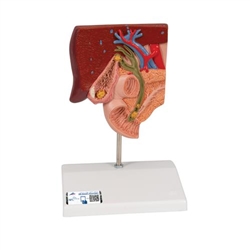 3B Scientific Gallstone Model - 3B Smart Anatomy