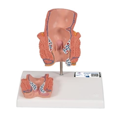 3B Scientific Hemorrhoid Model - 3B Smart Anatomy