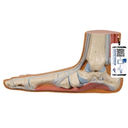 3B Scientific Flat Foot (Pes Planus) Model - 3B Smart Anatomy