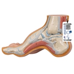 3B Scientific Hollow Foot (Pes Cavus) Model - 3B Smart Anatomy