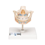 3B Scientific Milk Denture Model with Remaining Teeth - 3B Smart Anatomy