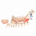 3B Scientific Comprehensive Lower Jaw Model (Left Half) with Diseased Teeth, Nerves, Vessels & Glands, 19 Part - 3B Smart Anatomy
