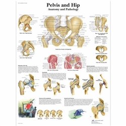 3B Scientific Pelvis and Hip Chart - Anatomy and Pathology (Laminated)