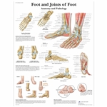 3B Scientific Foot and Joints of Foot Chart - Anatomy and Pathology (Laminated)