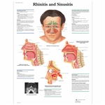 3B Scientific Rhinitis and Sinusitis Chart (Laminated)