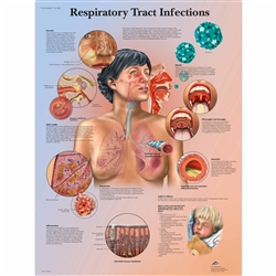 3B Scientific Respiratory Tract Infections Chart (Laminated)