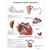 3B Scientific Common Cardiac Disorders Chart (Laminated)