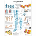 3B Scientific Varicose Veins Chart (Laminated)