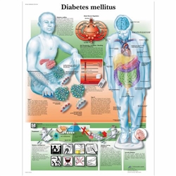 3B Scientific Diabetes Mellitus Chart (Laminated)