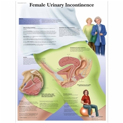 3B Scientific Female Urinary Incontinence Chart (Laminated)
