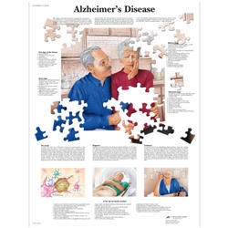 3B Scientific Alzheimer's Disease Chart (Laminated)
