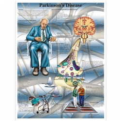 3B Scientific Parkinson's Disease Chart (Laminated)