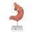 3B Scientific Human Stomach Model with Gastric Band, 2 part - 3B Smart Anatomy