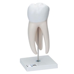 3B Scientific Giant Molar with Dental Cavities Human Tooth Model, 15 Times Life - Size, 6 Part - 3B Smart Anatomy