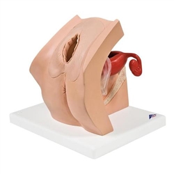 3B Scientific Model for Gynecological Patient Education - 3B Smart Anatomy