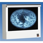 Wolf X-Ray 28001 Vuplus Mammography Viewer - Single Unit