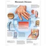 3B Scientific Rheumatic Diseases Chart (Non - Laminated)