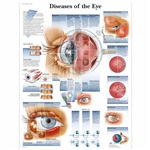 3B Scientific Diseases of the Eye Chart (Non Laminated)