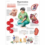 3B Scientific Hypertension Chart (Non Laminated)