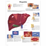 3B Scientific Hepatitis Chart (Non Laminated)