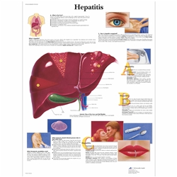 3B Scientific Hepatitis Chart (Non Laminated)