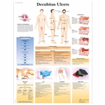 3B Scientific Decubitus Ulcers Chart (Non Lamination)