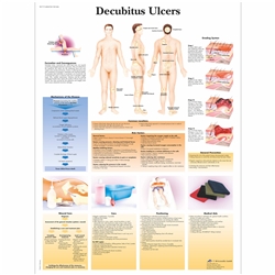 3B Scientific Decubitus Ulcers Chart (Non Lamination)