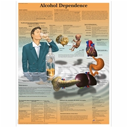 3B Scientific Alcohol Dependence Chart (Non Lamination)