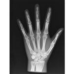 ERLER ZIMMER X-ray Phantom Hand, Opaque